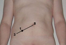 TOUCHER CE POINT ET ELIMINER LES SORCELLERIES PROGRAMMEES